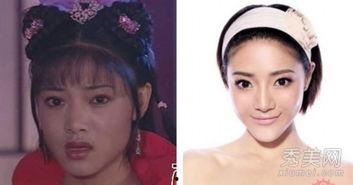 整容照片前后对比